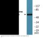 Tyrosine Hydroxylase (Phospho-Ser40) Colorimetric Cell-Based ELISA Kit