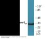Caspase 6 (Phospho-Ser257) Colorimetric Cell-Based ELISA Kit