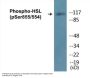 HSL (Phospho-Ser855/554) Colorimetric Cell-Based ELISA Kit