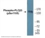 PLCbeta3 (Phospho-Ser1105) Colorimetric Cell-Based ELISA Kit