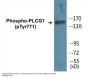 PLCG1 (Phospho-Tyr771) Colorimetric Cell-Based ELISA Kit