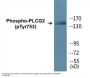 PLCG2 (Phospho-Tyr753) Colorimetric Cell-Based ELISA Kit