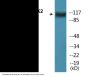 PYK2 (Phospho-Tyr881) Colorimetric Cell-Based ELISA Kit