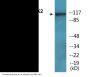 PYK2 (Phospho-Tyr580) Colorimetric Cell-Based ELISA Kit