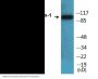 Dynamin-1 (Phospho-Ser774) Colorimetric Cell-Based ELISA Kit