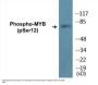 MYB (Phospho-Ser12) Colorimetric Cell-Based ELISA Kit