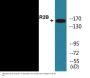 NMDAR2B (Phospho-Tyr1474) Colorimetric Cell-Based ELISA Kit