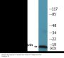 Survivin (Phospho-Thr34) Colorimetric Cell-Based ELISA Kit