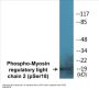 Myosin regulatory light chain 2 (Phospho-Ser18) Colorimetric Cell-Based ELISA Kit