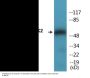 PAK2 (Phospho-Ser20) Colorimetric Cell-Based ELISA Kit