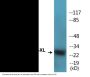BCL-XL (Phospho-Thr47) Colorimetric Cell-Based ELISA Kit