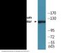 Calcium Sensing Receptor (Phospho-Thr888) Colorimetric Cell-Based ELISA Kit