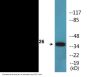 CD226 (Phospho-Ser329) Colorimetric Cell-Based ELISA Kit