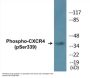 CXCR4 (Phospho-Ser339) Colorimetric Cell-Based ELISA Kit