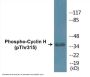 Cyclin H (Phospho-Thr315) Colorimetric Cell-Based ELISA Kit