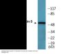 Keratin 8 (Phospho-Ser432) Colorimetric Cell-Based ELISA Kit