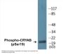 CRYAB (Phospho-Ser19) Colorimetric Cell-Based ELISA Kit