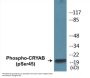 CRYAB (Phospho-Ser45) Colorimetric Cell-Based ELISA Kit