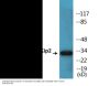 p57 Kip2 (Phospho-Thr310) Colorimetric Cell-Based ELISA Kit