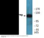 PDGFRbeta (Phospho-Tyr740) Colorimetric Cell-Based ELISA Kit