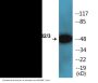 Smad2/3 (Phospho-Thr8) Colorimetric Cell-Based ELISA Kit