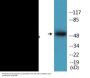 Tryptophan Hydroxylase (Phospho-Ser58) Colorimetric Cell-Based ELISA Kit