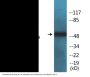 Tryptophan Hydroxylase (Phospho-Ser260) Colorimetric Cell-Based ELISA Kit