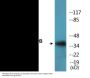 AurB (Phospho-Thr232) Colorimetric Cell-Based ELISA Kit