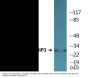 Calsenilin/KCNIP3 (Phospho-Ser63) Colorimetric Cell-Based ELISA Kit