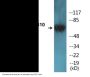 GRB10 (Phospho-Tyr67) Colorimetric Cell-Based ELISA Kit