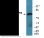 IL-10Ralpha (Phospho-Tyr496) Colorimetric Cell-Based ELISA Kit