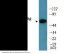 IL-2Rbeta (Phospho-Tyr364) Colorimetric Cell-Based ELISA Kit