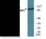 IL-4R/CD124 (Phospho-Tyr497) Colorimetric Cell-Based ELISA Kit
