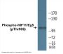 KIF11/Eg5 (Phospho-Thr926) Colorimetric Cell-Based ELISA Kit