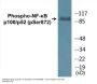 NF-kappaB p100/p52 (Phospho-Ser872) Colorimetric Cell-Based ELISA Kit