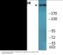 mTOR (Phospho-Thr2446) Colorimetric Cell-Based ELISA Kit