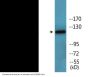 Telomerase (Phospho-Ser824) Colorimetric Cell-Based ELISA Kit