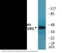 Casein Kinase II alpha (Phospho-Tyr255) Colorimetric Cell-Based ELISA Kit