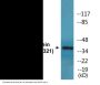 Casein Kinase I alpha (Phospho-Tyr321) Colorimetric Cell-Based ELISA Kit