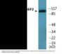 ARHGEF2 (Phospho-Ser885) Colorimetric Cell-Based ELISA Kit