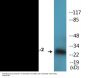 BCL-2 (Phospho-Thr56) Colorimetric Cell-Based ELISA Kit