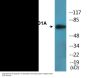 FOXO1A (Phospho-Ser256) Colorimetric Cell-Based ELISA Kit