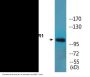 GluR1 (Phospho-Ser863) Colorimetric Cell-Based ELISA Kit