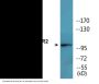 GluR2 (Phospho-Ser880) Colorimetric Cell-Based ELISA Kit