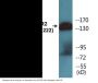 HER2 (Phospho-Tyr1221/Tyr1222) Colorimetric Cell-Based ELISA Kit