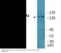 HER2 (Phospho-Tyr1248) Colorimetric Cell-Based ELISA Kit