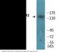 HER2 (Phospho-Tyr877) Colorimetric Cell-Based ELISA Kit