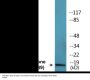 Histone H2A.X (Phospho-Ser139) Colorimetric Cell-Based ELISA Kit
