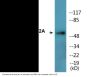 MEF2A (Phospho-Thr319) Colorimetric Cell-Based ELISA Kit