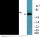 Merlin (Phospho-Ser518) Colorimetric Cell-Based ELISA Kit